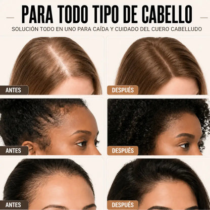 Pleena™ — Frena la Caída, Estimula el Crecimiento y Luce un Cabello Más Denso
