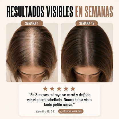 Pleena™ — Frena la Caída, Estimula el Crecimiento y Luce un Cabello Más Denso